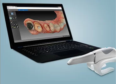 3D digital dental impression from the CS 3600 scanner shown on screen