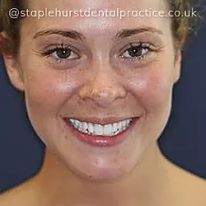 Patient smiling after treatment