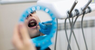 Root Canal Treatment in Staplehurst